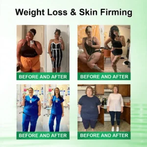 🧬Alcuras™ Moringa × Berberine × AMPK 8-Benefit Slimming & Metabolic Nano Microneedle Patch