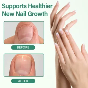 Alcuras® Nail Detox Penetration Serum Pen