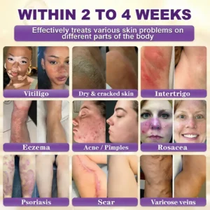 Made and Shipped from USA ✨Alcuras™ Biotin 10-in-1 Skin Restoration Cream 🍀