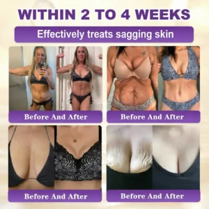 Made and Shipped from USA ✨Alcuras™ Biotin 10-in-1 Skin Restoration Cream 🍀