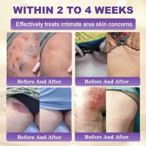 Made and Shipped from USA ✨Alcuras™ Biotin 10-in-1 Skin Restoration Cream 🍀