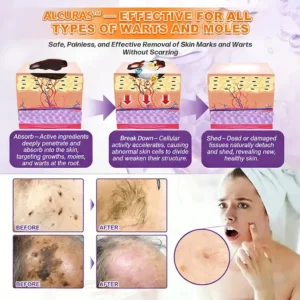 Made and Shipped from USA ✨Alcuras™ Biotin 10-in-1 Skin Restoration Cream 🍀