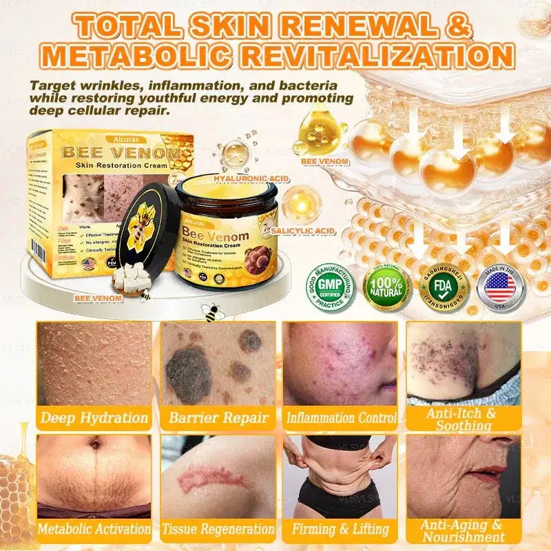 Alcuras Bee Venom Cream – Fast Skin Repair | Made in USA | 80% OFF!