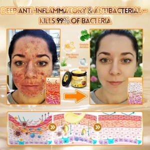 Alcuras Bee Venom Cream – Fast Skin Repair | Made in USA | 80% OFF!