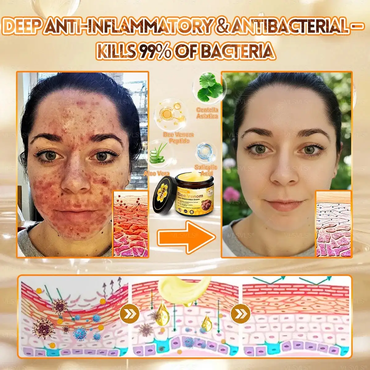 Alcuras Bee Venom Cream – Fast Skin Repair | Made in USA | 80% OFF!