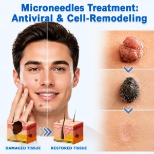 Alcuras®2-in-1 Microneedle & Hydrocolloid Patch🍀| Removes Raised Moles, Acne, Flat Warts & Skin Tags | Helps Improve Wrinkles, Scars & Blemishes | Invisible Patches for Face & Body