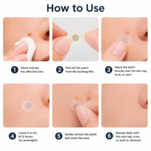 Alcuras®2-in-1 Microneedle & Hydrocolloid Patch🍀| Removes Raised Moles, Acne, Flat Warts & Skin Tags | Helps Improve Wrinkles, Scars & Blemishes | Invisible Patches for Face & Body