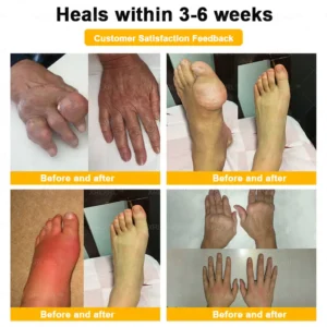 Alcuras® Bee Venom Pain-Relief Bone Healing Cream 🇺🇸(Specially for older adults)