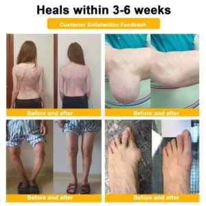 Alcuras® Bee Venom Pain-Relief Bone Healing Cream 🇺🇸(Specially for older adults)