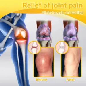 Alcuras® Bee Venom Pain-Relief Bone Healing Cream 🇺🇸(Specially for older adults)