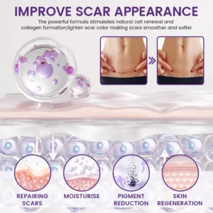 Alcuras® ReGenScar Stem Cell Scar Gel