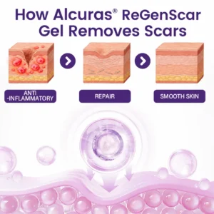 Alcuras® ReGenScar Stem Cell Scar Gel