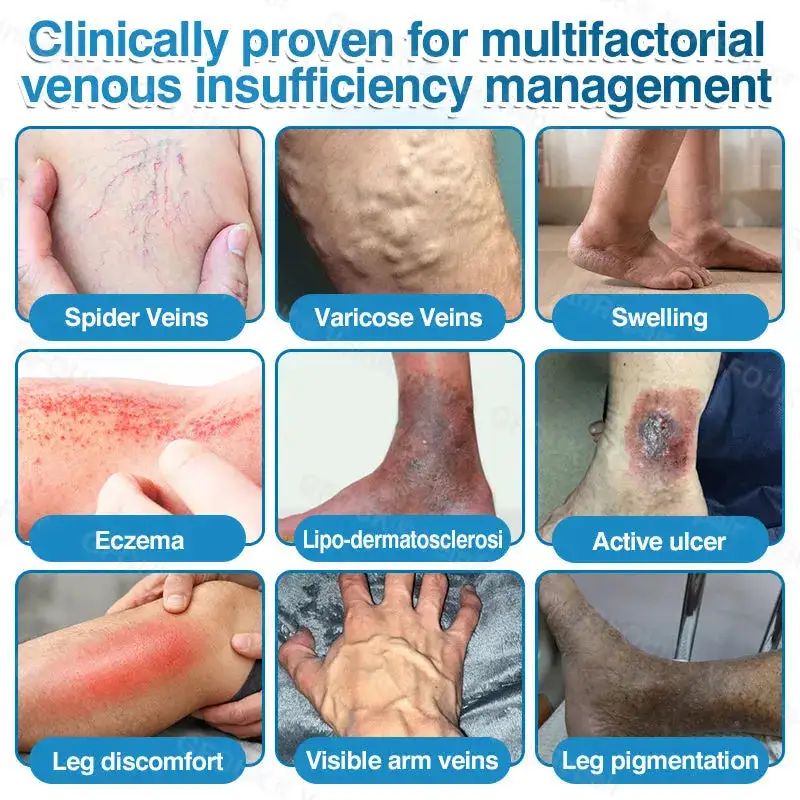 🇦🇺🏆✅️🏃Alcuras® VeinRepair Microneedle Patch Roll⚡Instant Relief, Long-Term Results