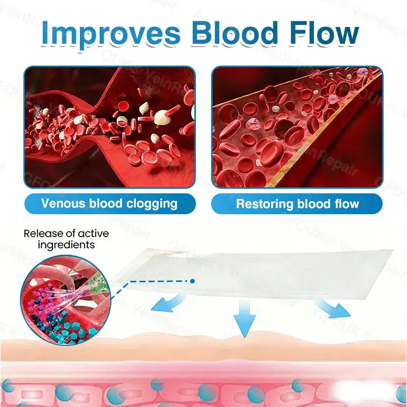 🇦🇺🏆✅️🏃Alcuras® VeinRepair Microneedle Patch Roll⚡Instant Relief, Long-Term Results